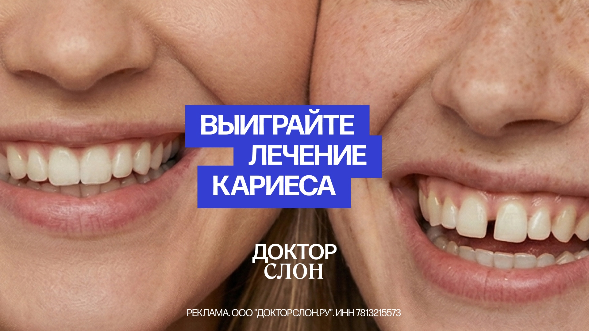 Выиграйте лечение кариеса (16х9)